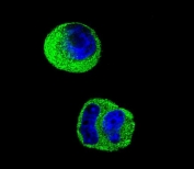 Immunofluorescent staining of human MCF7 cells with MMP2 antibody (green) and DAPI nuclear stain (blue).