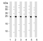 Western blot testing of human 1) liver, 2) HeLa, 3) HepG2, 4) MCF7, 5) mouse Neuro-2a and 6) rat PC-12 cell lysate with PSMA5 antibody. Predicted molecular weight ~26 kDa.