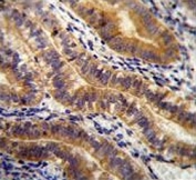 IHC testing of FFPE human uterus tissue with Angiopoietin 2 antibody. HIER: steam section in pH6 citrate buffer for 20 min and allow to cool prior to staining.