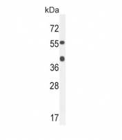 Western blot testing of mouse heart tissue with Alcohol dehydrogenase 4 antibody. Predicted molecular weight ~40 kDa.