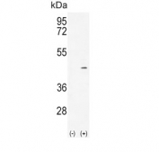 Western blot testing of 1) non-transfected and 2) transfected 293 cell lysate with Alcohol dehydrogenase 4 antibody. Predicted molecular weight ~40 kDa.
