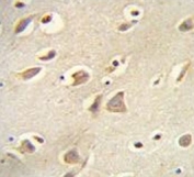 IHC testing of FFPE human brain tissue with MCH Receptor 1 antibody. HIER: steam section in pH6 citrate buffer for 20 min and allow to cool prior to staining.