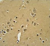 IHC testing of FFPE human brain tissue with Alpha-amylase 2B antibody. HIER: steam section in pH6 citrate buffer for 20 min and allow to cool prior to staining.