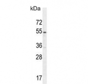 Western blot testing of human Jurkat cell lysate with MPP1 antibody. Expected molecular weight 52-55 kDa.