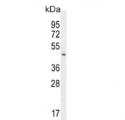 Western blot testing of mouse bladder tissue lysate with Prolyl-tRNA synthetase antibody. Predicted molecular weight ~53 kDa.