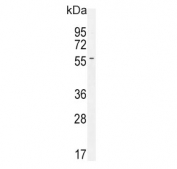 Western blot testing of human CEM cell lysate with Inhibin beta A chain antibody. Predicted molecular weight ~47 kDa.