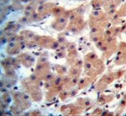 IHC testing of FFPE human uterus tissue with Inhibin beta B chain antibody. HIER: steam section in pH6 citrate buffer for 20 min and allow to cool prior to staining.