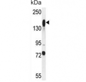 Western blot testing of mouse liver tissue lysate with Additional sex combs-like protein 1 antibody. Predicted molecular weight ~165 kDa.