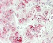IHC testing of FFPE human adrenal tissue with CPM antibody. HIER: steam section in pH6 citrate buffer for 20 min and allow to cool prior to staining.