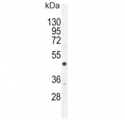 Western blot testing of human A549 cell lysate with CMGA antibody. Expected molecular weight: 50-75 kDa depending on glycosylation level.