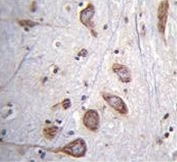 IHC testing of FFPE human brain tissue with Phospholipase C-L2 antibody. HIER: steam section in pH6 citrate buffer for 20 min and allow to cool prior to staining.