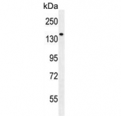 Western blot testing of human NCI-H460 cell lysate with Phospholipase C-L2 antibody. Predicted molecular weight ~126 kDa.