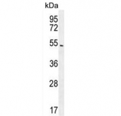 Western blot testing of human A549 cell lysate with ARRB1 antibody. Predicted molecular weight ~47 kDa.