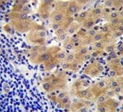 IHC testing of FFPE human liver tissue with Gamma-glutamyl hydrolase antibody. HIER: steam section in pH6 citrate buffer for 20 min and allow to cool prior to staining.