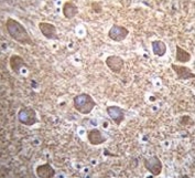 IHC testing of FFPE human brain tissue with CalDAG-GEFI antibody. HIER: steam section in pH6 citrate buffer for 20 min and allow to cool prior to staining.