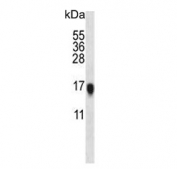 Western blot testing of mouse heart lysate with VSNL1 antibody. Predicted molecular weight ~17 kDa.