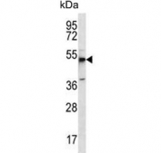 Western blot testing of human MCF7 cell lysate with Mboat4 antibody. Predicted molecular weight ~50 kDa.