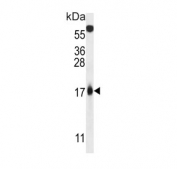 Western blot testing of human HEK293 cell lysate with Tumor suppressor ARF antibody. Predicted molecular weight ~14 kDa.