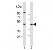 Western blot testing of human 1) HepG2 and 2) skeletal muscle lysate with ASAM antibody. Predicted molecular weight ~41 kDa.