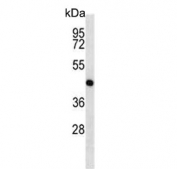 Western blot testing of mouse cerebellum tissue lysate with MEK1 antibody. Predicted molecular weight ~43 kDa.
