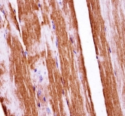 IHC testing of FFPE mouse skeletal muscle tissue with c-Raf antibody. HIER: steam section in pH6 citrate buffer for 20 min and allow to cool prior to staining.