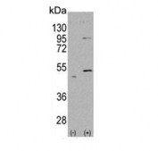 Western blot testing of 1) non-transfected and 2) transfected 293 cell lysate with ALDH5A1 antibody. Predicted molecular weight ~57 kDa.