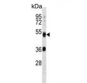 Western blot testing of mouse cerebellum tissue lysate with ATG4B antibody. Expected molecular weight: 37-52 kDa (multiple isoforms).