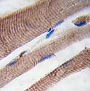 IHC testing of FFPE human skeletal muscle tissue with PI3KC3 antibody. HIER: steam section in pH6 citrate buffer for 20 min and allow to cool prior to staining.
