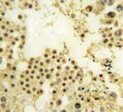 IHC testing of FFPE human testis tissue with ZNF219 antibody. HIER: steam section in pH6 citrate buffer for 20 min and allow to cool prior to staining.