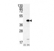 Western blot testing of 1) non-transfected and 2) transfected 293 cell lysate with SOX2 antibody.