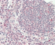 IHC testing of FFPE human spleen tissue with VAMP-8 antibody. HIER: steam section in pH6 citrate buffer for 20 min and allow to cool prior to staining.