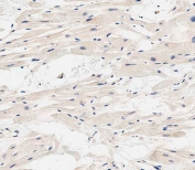 IHC testing of FFPE human heart tissue with EHD2 antibody. HIER: steam section in pH9 EDTA for 20 min and allow to cool prior to staining.
