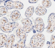 IHC testing of FFPE human placental tissue with EHD2 antibody. HIER: steam section in pH9 EDTA for 20 min and allow to cool prior to staining.