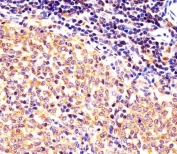 IHC testing of FFPE mouse spleen tissue with Nr4a2 antibody. HIER: steam section in pH6 citrate buffer for 20 min and allow to cool prior to staining.