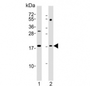 Western blot testing of human 1) HL60 and 2) Jurkat cell lysate with KiSS-1 antibody. Predicted molecular weight ~15 kDa, commonly observed at 15-20 kDa.
