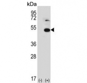 Western blot testing of 1) non-transfected and 2) transfected 293 cell lysate with TRIP13 antibody. Predicted molecular weight ~49 kDa.