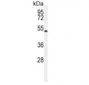 Western blot testing of human HEK293 cell lysate with ASMT antibody. Predicted molecular weight ~38 kDa.