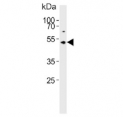 Western blot testing of human Y79 cell lysate with ASMT antibody. Predicted molecular weight ~38 kDa.