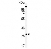 Western blot testing of mouse liver tissue lysate with ZDHHC21 antibody. Predicted molecular weight ~31 kDa.