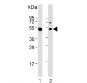 Western blot testing of human 1) Daudi and 2) Ramos cell lysate with Lymphocyte Specific Protein 1 antibody. Predicted molecular weight: ~37 kDa but is routinely observed at ~52 kDa (PMID: 15684321).