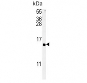 Western blot testing of human HEK293 cell lysate with ADCYAP1 antibody. Predicted molecular weight ~19 kDa but may be observed at up to 25 kDa.