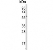 Western blot testing of human NCI-H460 cell lysate with Beta-secretase 1 antibody. Predicted molecular weight ~56 kDa.