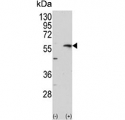 Western blot testing of 1) non-transfected and 2) transfected 293 cell lysate with Collagenase 3 antibody.