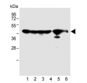 Western blot testing of 1) human A2058, 2) human HT-1080, 3) human MCF-7, 4) human NCI-H292, 5) mouse kidney and 6) rat kidney tissue lysate with MMP14 antibody. Predicted molecular weight ~66 kDa (pro form), ~54 kDa (active form), ~44 kDa (inactive form).