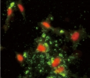Immunofluorescent staining of human HeLa cells with ARPC1A antibody (green) and PI (red).