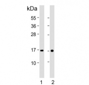 Western blot testing of human 1) placenta and 2) plasma lysate with Transthyretin antibody. Predicted molecular weight ~16 kDa.