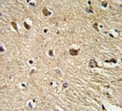 IHC testing of FFPE human brain tissue with BGN antibody. HIER: steam section in pH6 citrate buffer for 20 min and allow to cool prior to staining.