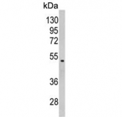Western blot testing of human MDA-MB-231 cell lysate with Galactose-1-phosphate uridylyltransferase antibody. Predicted molecular weight ~43 kDa.