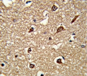 IHC testing of FFPE human tonsil tissue with HLA-DRB1 antibody. HIER: steam section in pH6 citrate buffer for 20 min and allow to cool prior to staining.
