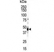 Western blot testing of human NCI-H460 cell lysate with CAMK1 delta antibody. Predicted molecular weight: ~40 kDa.
